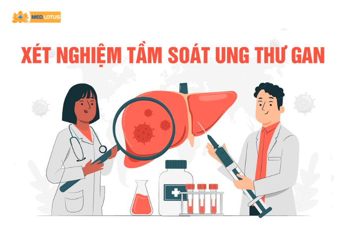 Xét nghiệm máu giúp tầm soát ung thư gan