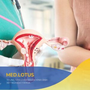 Tầm soát ung thư buồng trứng