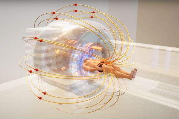 Hoạt động của tia từ trường trong chụp MRI